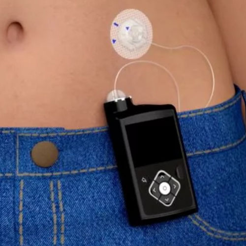 Insulin Pump components