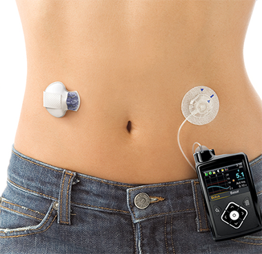 Continuous Glucose Monitoring | medtronic-diabetes.com.au