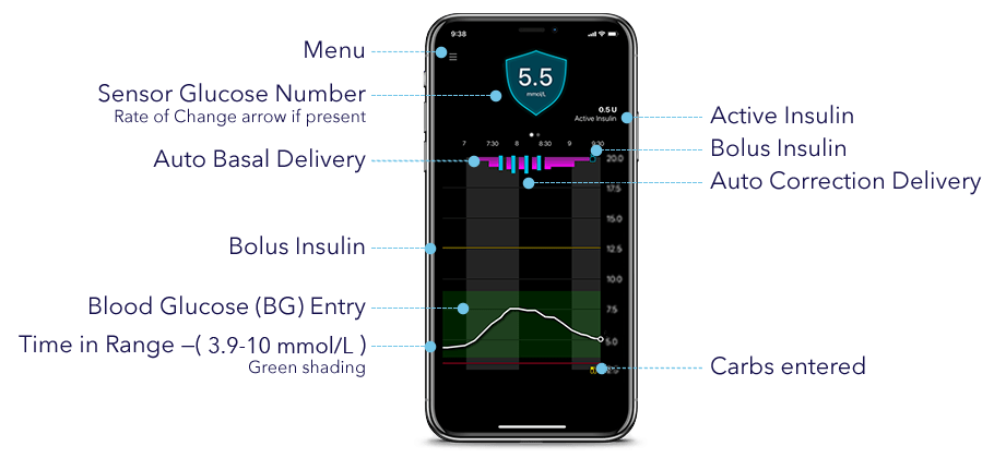MiniMed Mobile App Home Screen