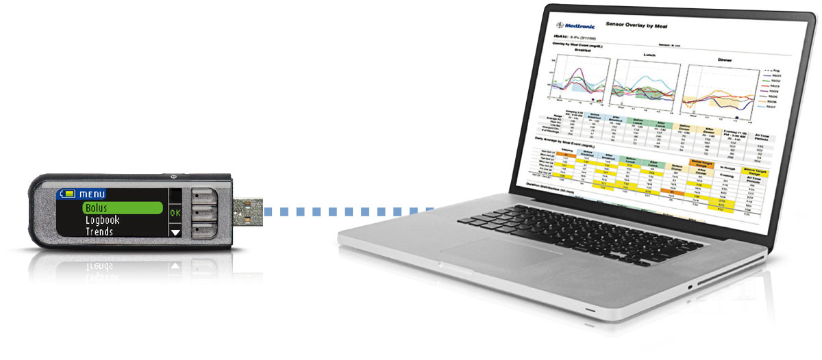 Carelink Software Support Medtronic Diabetes